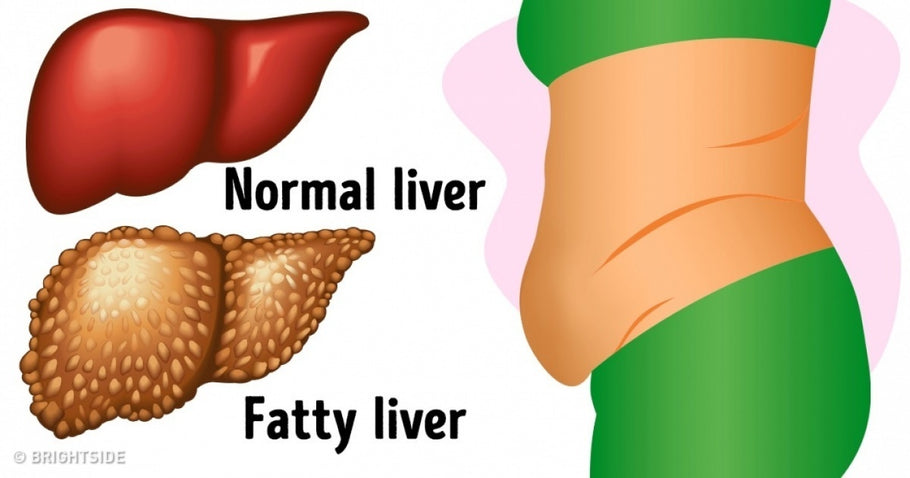 16 warning signs your liver is overloaded with toxins that are making you fat